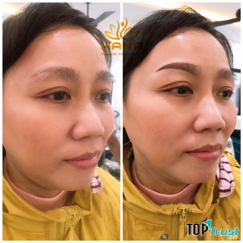 Thẩm Mỹ Viện Hana