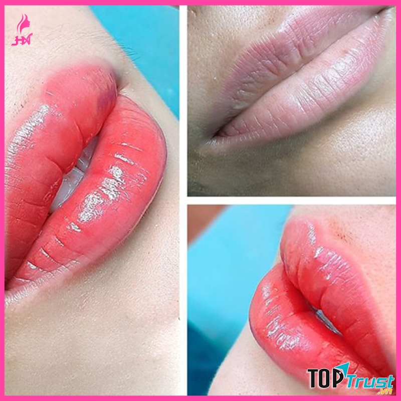 Thẩm Mỹ Viện HANA Sài Gòn