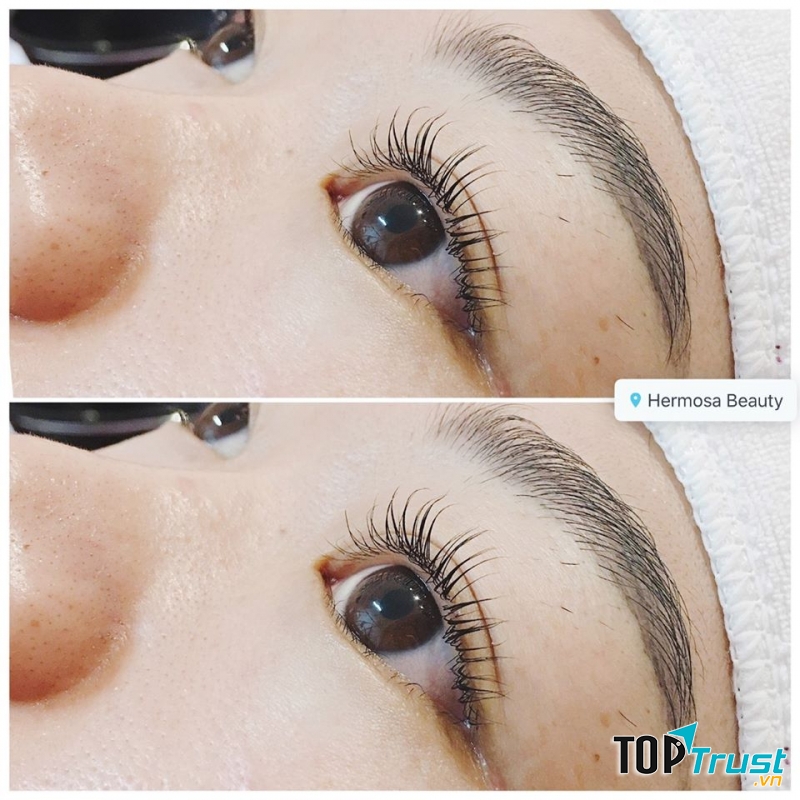 Thẩm Mỹ Viện Hermosa