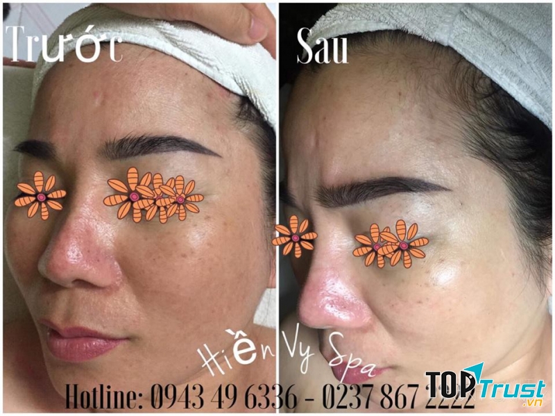 Thẩm Mỹ Viện Hiền Vy