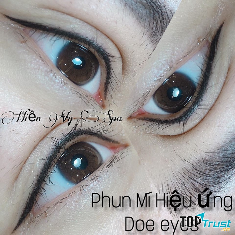 Thẩm Mỹ Viện Hiền Vy