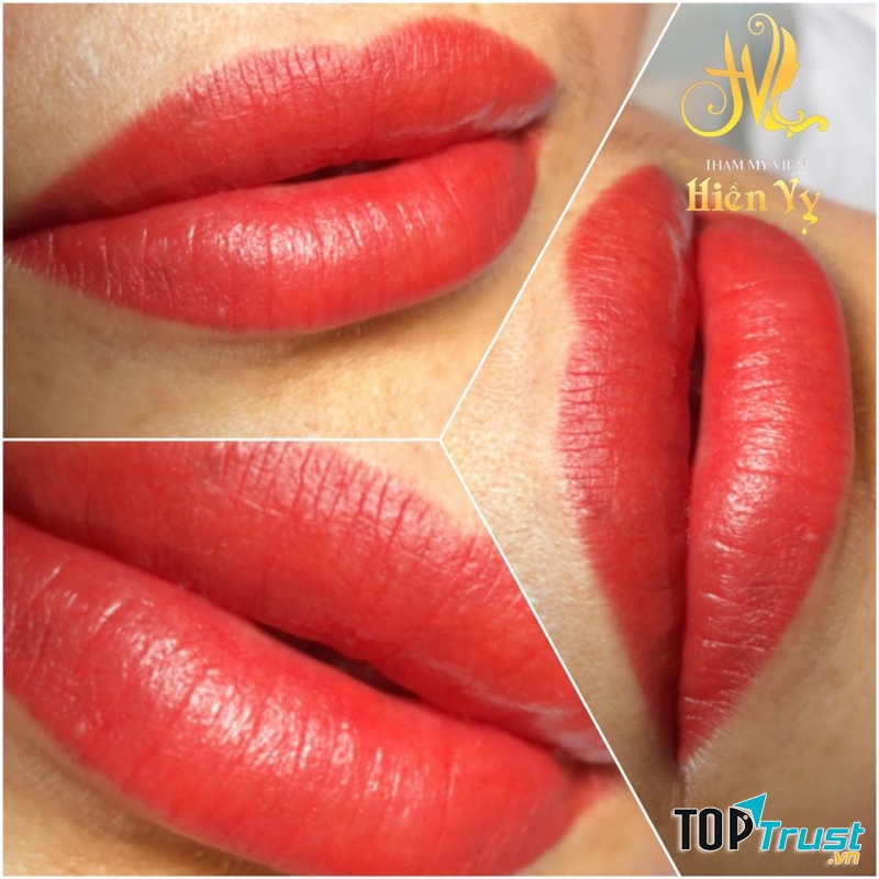 Thẩm Mỹ Viện Hiền Vy