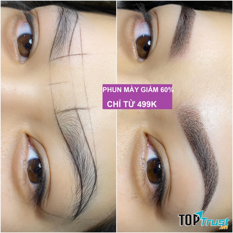 Thẩm Mỹ Viện Hoa Anh