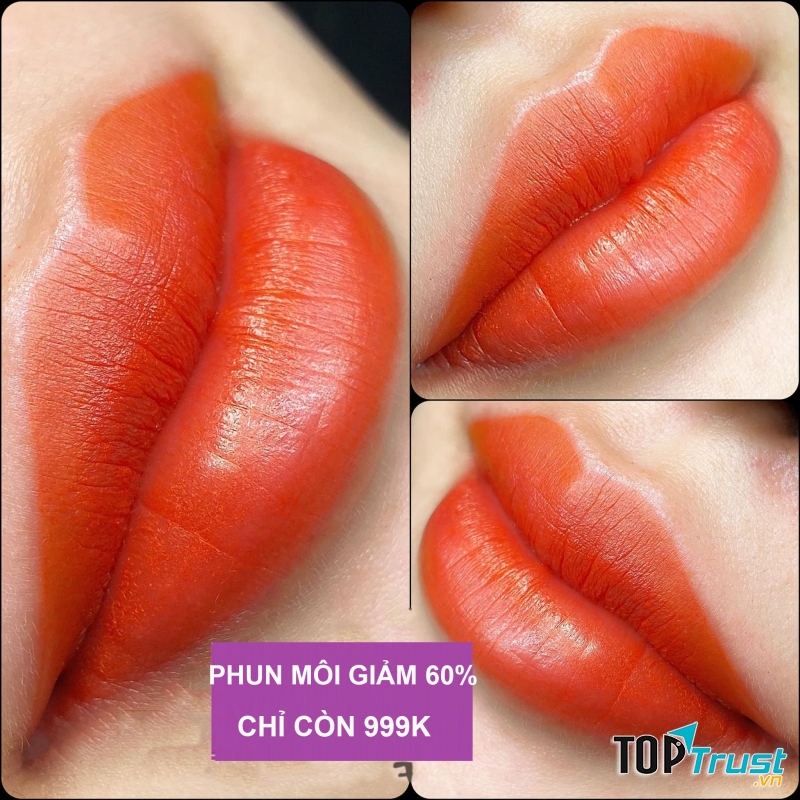 Thẩm Mỹ Viện Hoa Anh