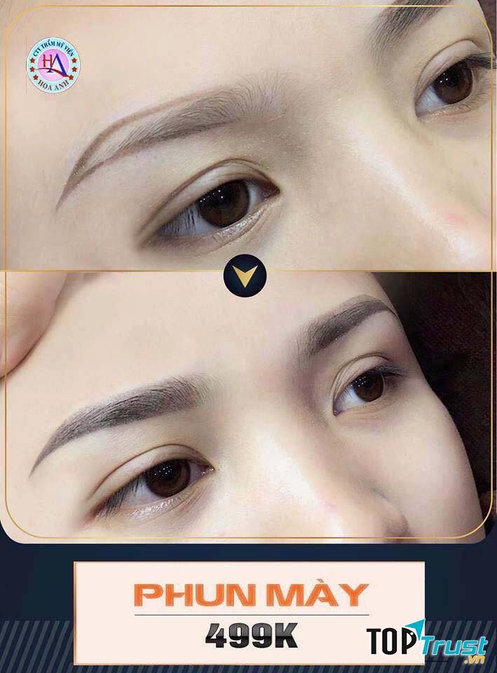 Thẩm Mỹ Viện Hoa Anh