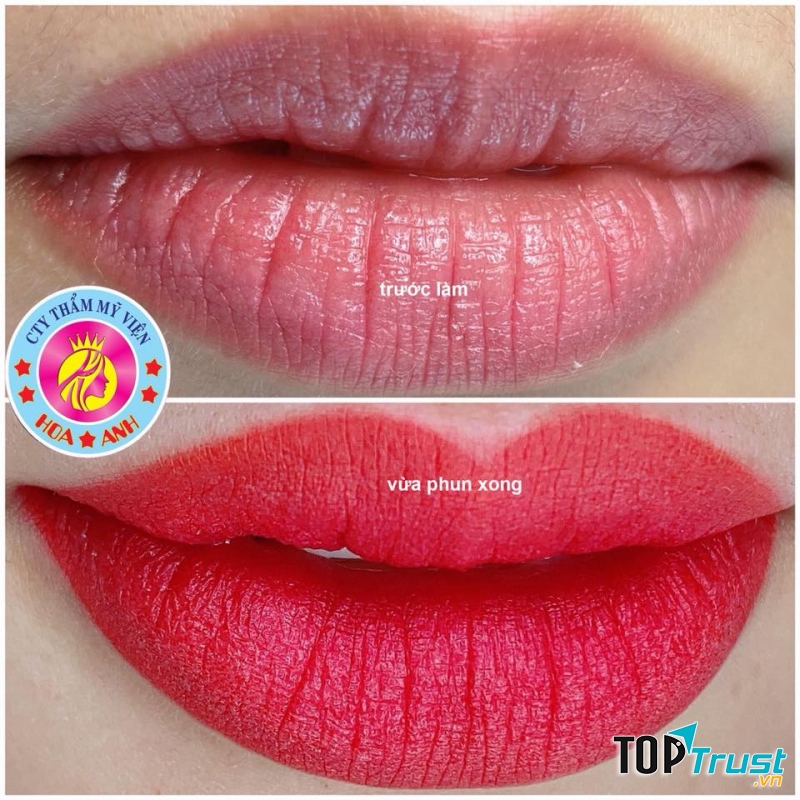 Thẩm Mỹ Viện Hoa Anh