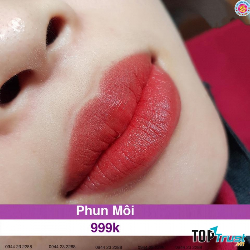 Thẩm Mỹ Viện Hoa Anh