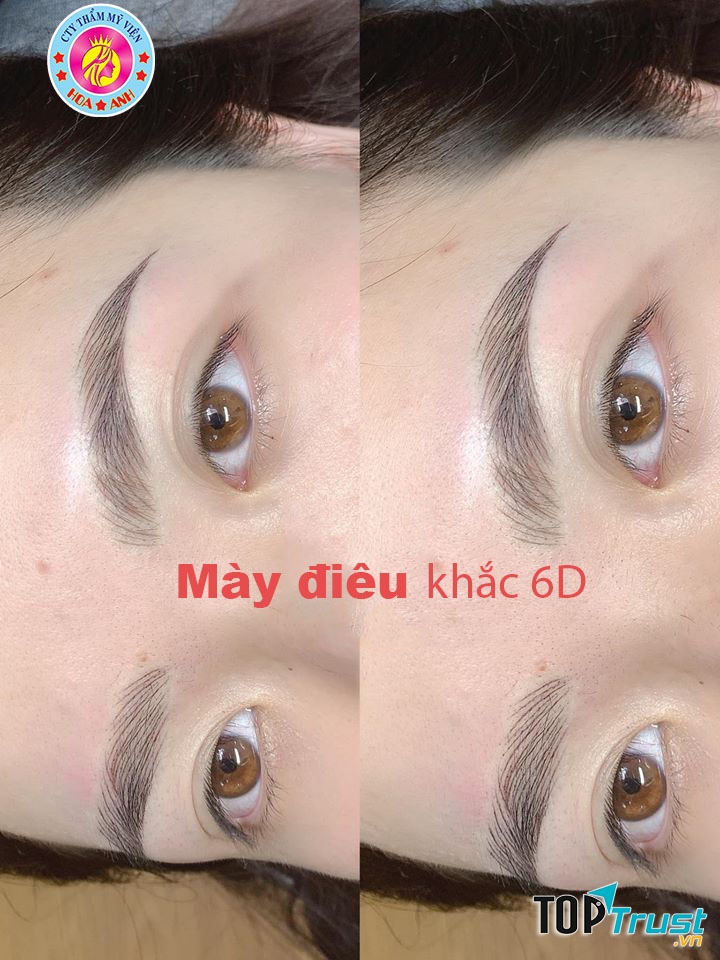 Thẩm Mỹ Viện Hoa Anh