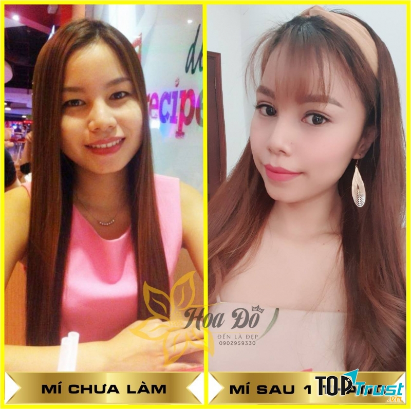 Thẩm Mỹ Viện Hoa Đô - Đến Là Đẹp