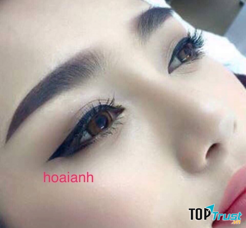 Thẩm mỹ viện Hoài Anh