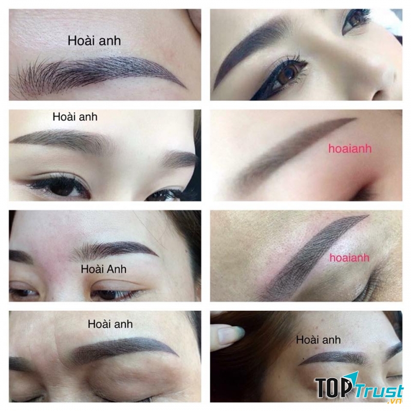 Thẩm mỹ viện Hoài Anh