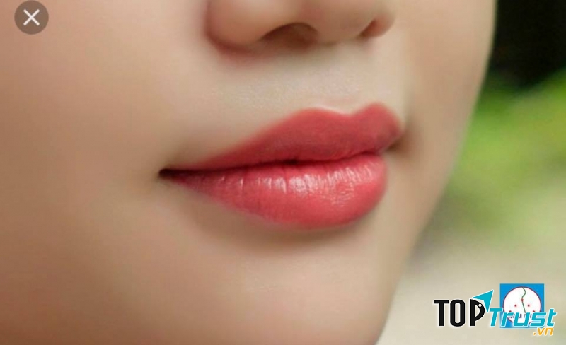 Thẩm mỹ viện Hoài Anh