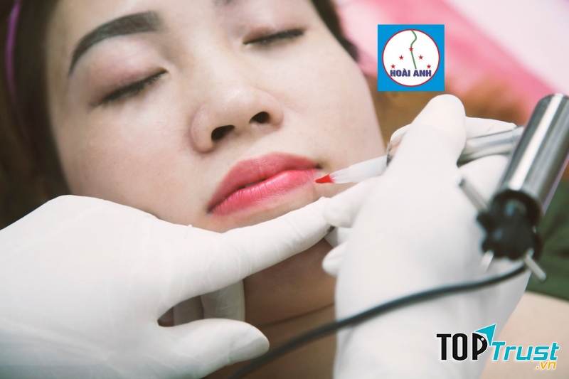 Thẩm mỹ viện Hoài Anh