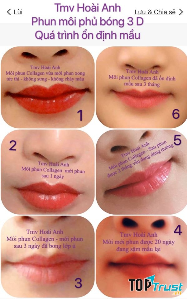 Thẩm mỹ viện Hoài Anh CN Quận 12