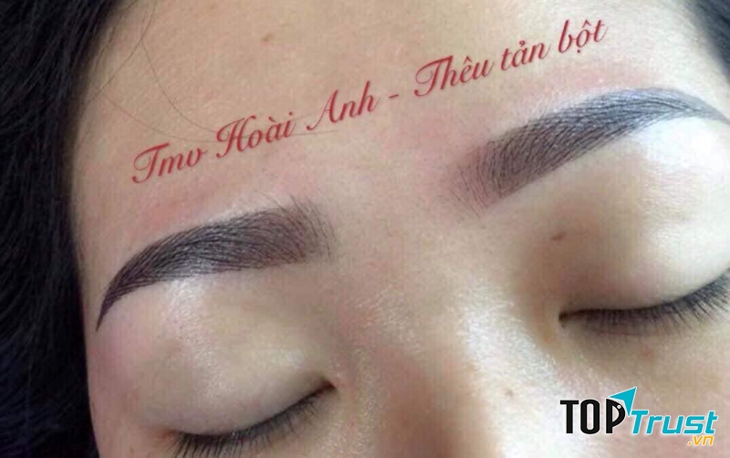 Thẩm mỹ viện Hoài Anh CN Quận 12