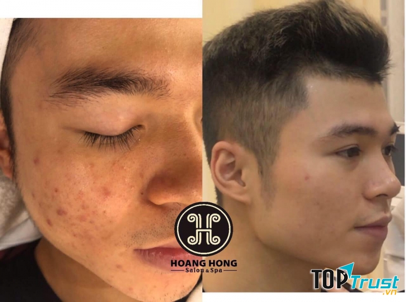 Thẩm Mỹ Viện Hoàng Hồng