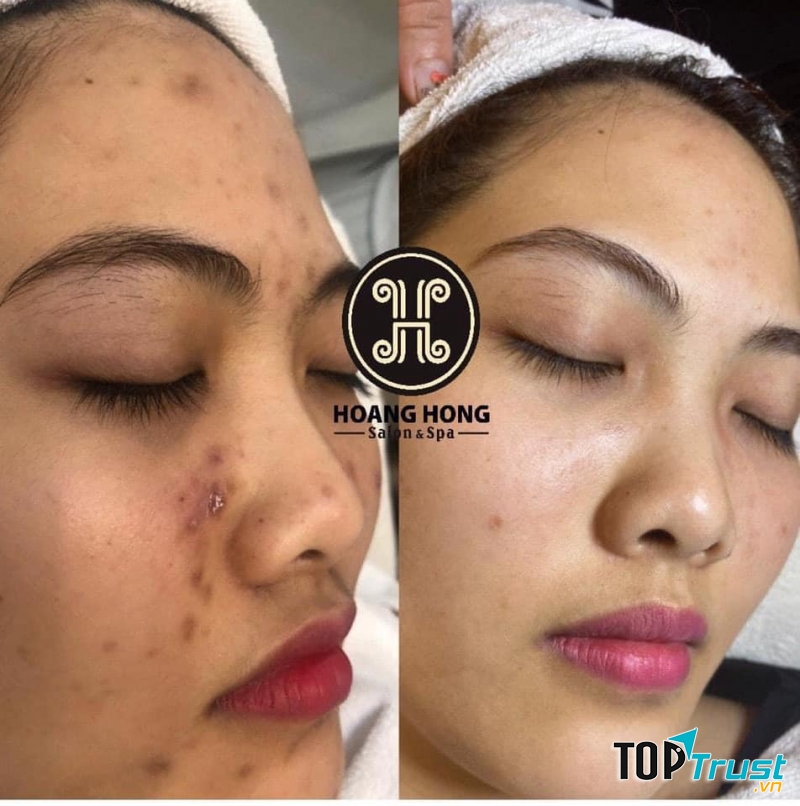 Thẩm Mỹ Viện Hoàng Hồng Ninh Bình