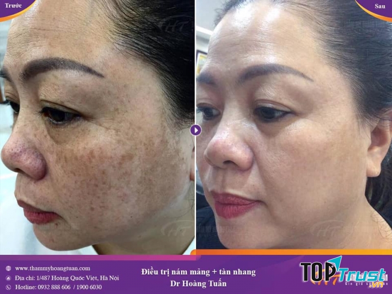 Thẩm mỹ viện Hoàng Tuấn