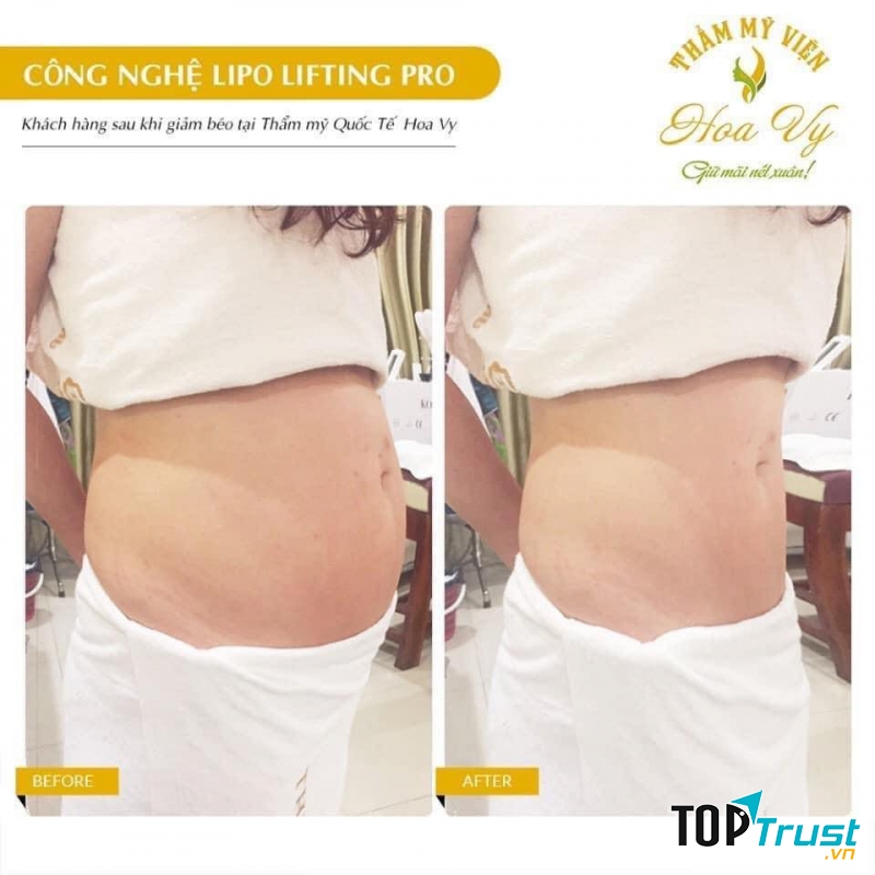 Thẩm Mỹ Viện HoaVy