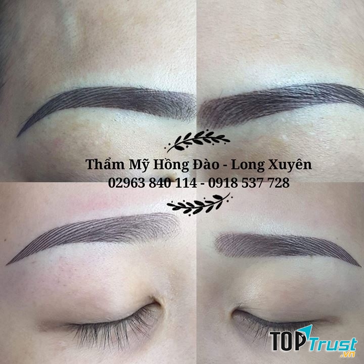 Thẩm mỹ viện Hồng Đào