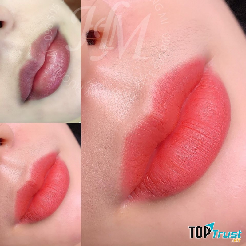 Thẩm Mỹ Viện Hương Mi