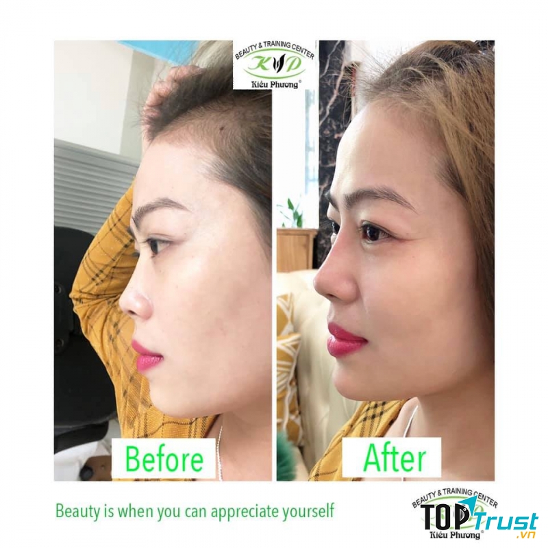 Thẩm mỹ viện Kiều Phương