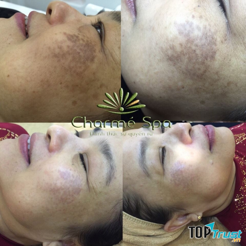 Thẩm Mỹ Viện Làm Đẹp - Charmé Spa