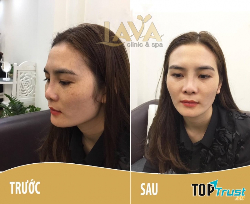 Thẩm Mỹ Viện LAVA
