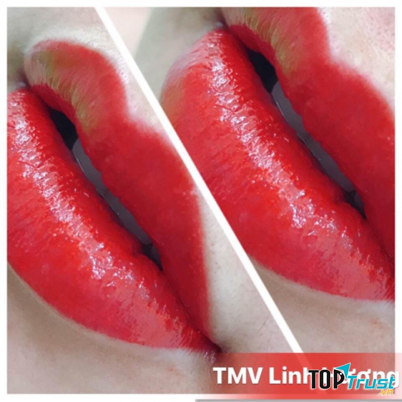 Phun môi tại thẩm mỹ Viện Linh Hương