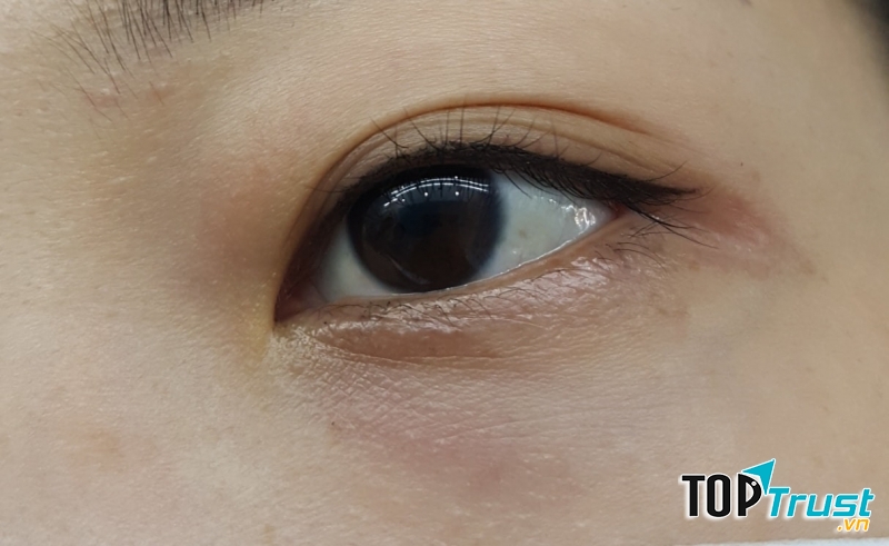 Thẩm Mỹ Viện Mai Linh