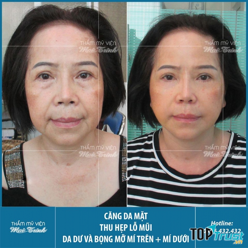 Thẩm Mỹ Viện MAI TRINH