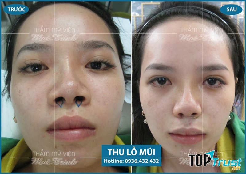 Thẩm Mỹ Viện MAI TRINH