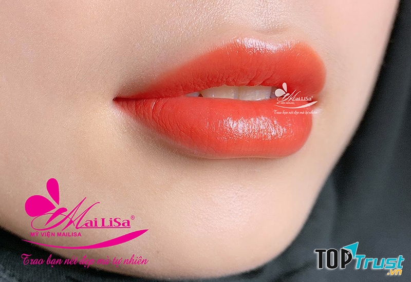 Thẩm Mỹ Viện Mailisa