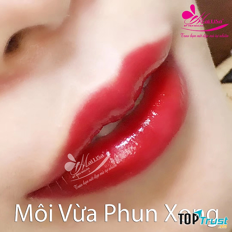 Thẩm Mỹ Viện Mailisa
