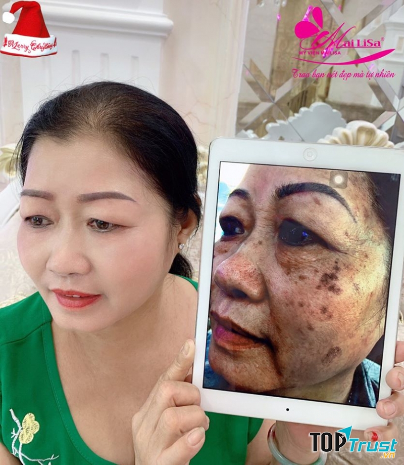 Thẩm Mỹ Viện Mailisa