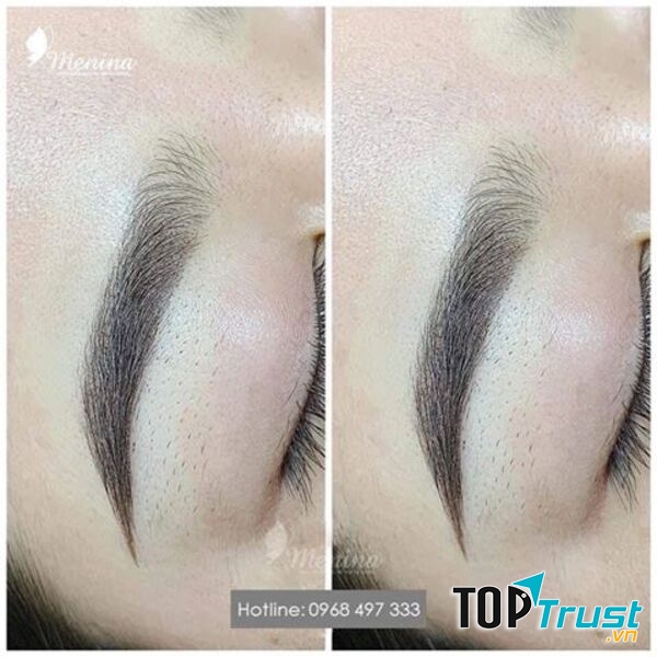 Thẩm mỹ viện Menina