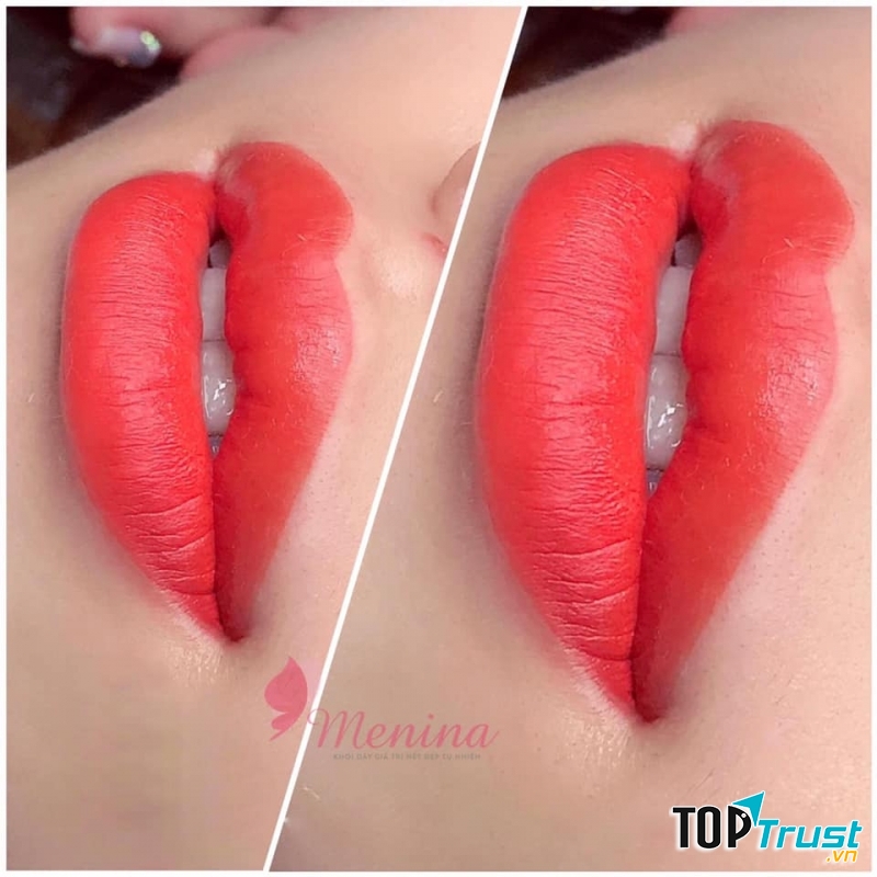 Thẩm mỹ viện Menina - Hạ Long