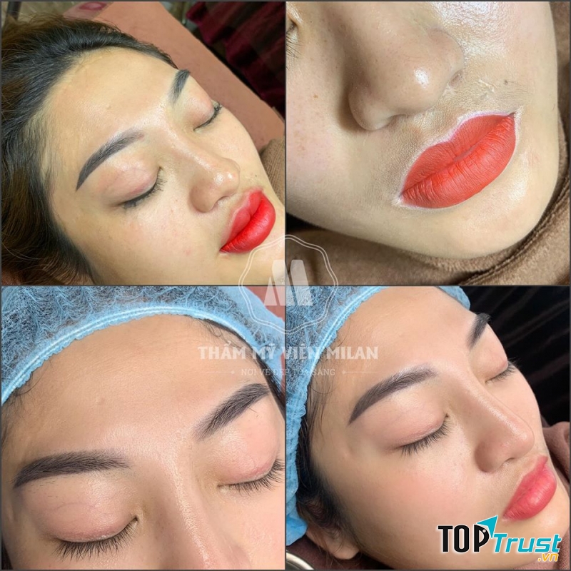 Thẩm Mỹ Viện Milan