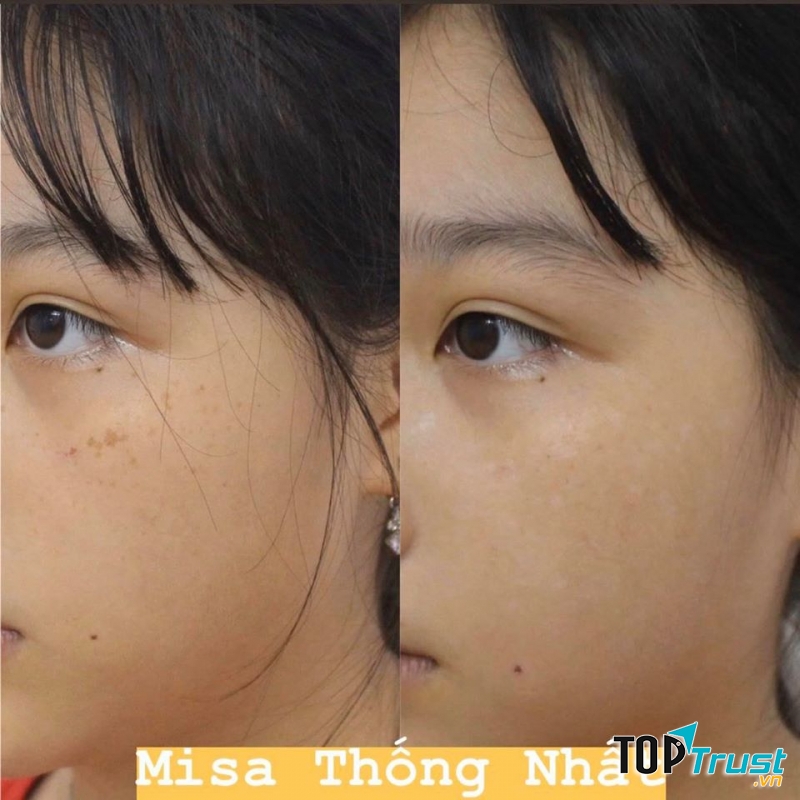 Thẩm mỹ viện Misa Thống Nhất