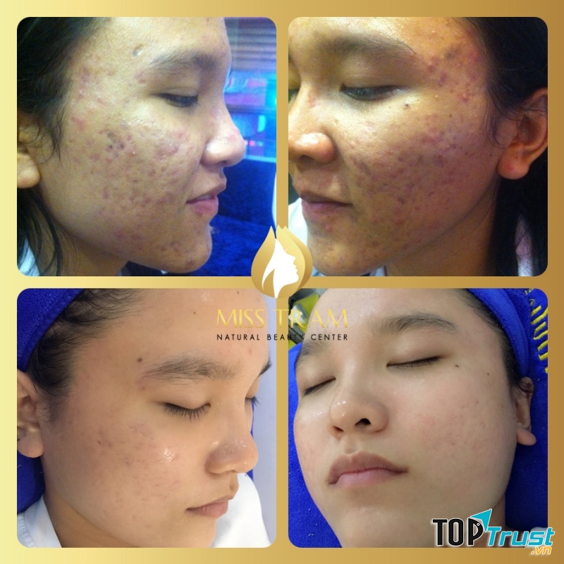 Thẩm mỹ viện Miss Trâm (Miss Tram – Natural Beauty Center)