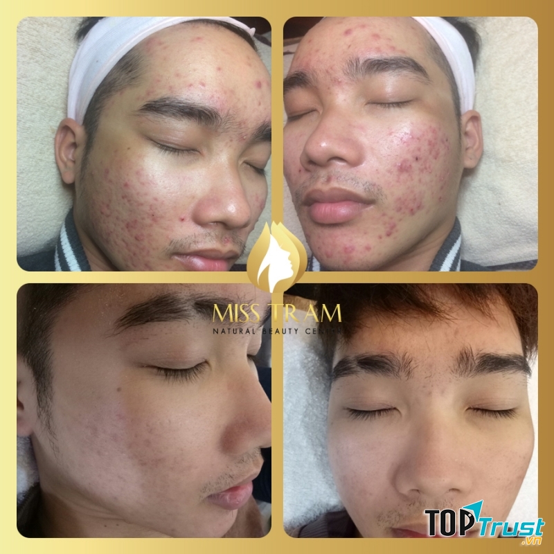 Thẩm mỹ viện Miss Trâm (Miss Tram – Natural Beauty Center)