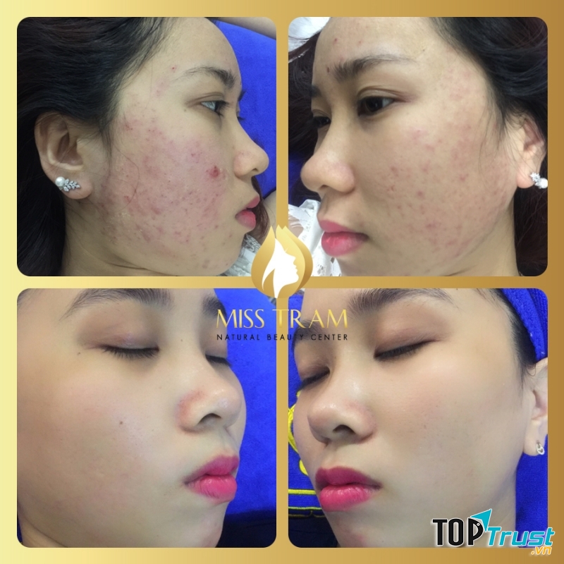 Thẩm mỹ viện Miss Trâm (Miss Tram – Natural Beauty Center)