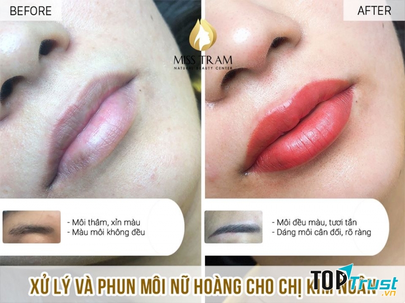 Thẩm mỹ viện Miss Tram Natural Beauty Center