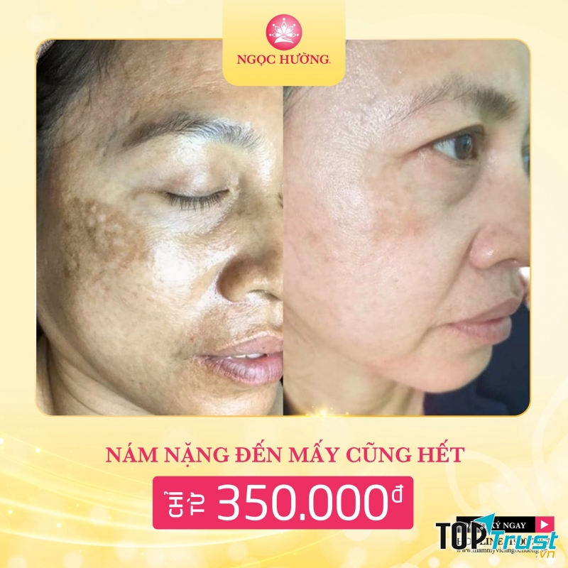 Thẩm Mỹ Viện Ngọc Hường