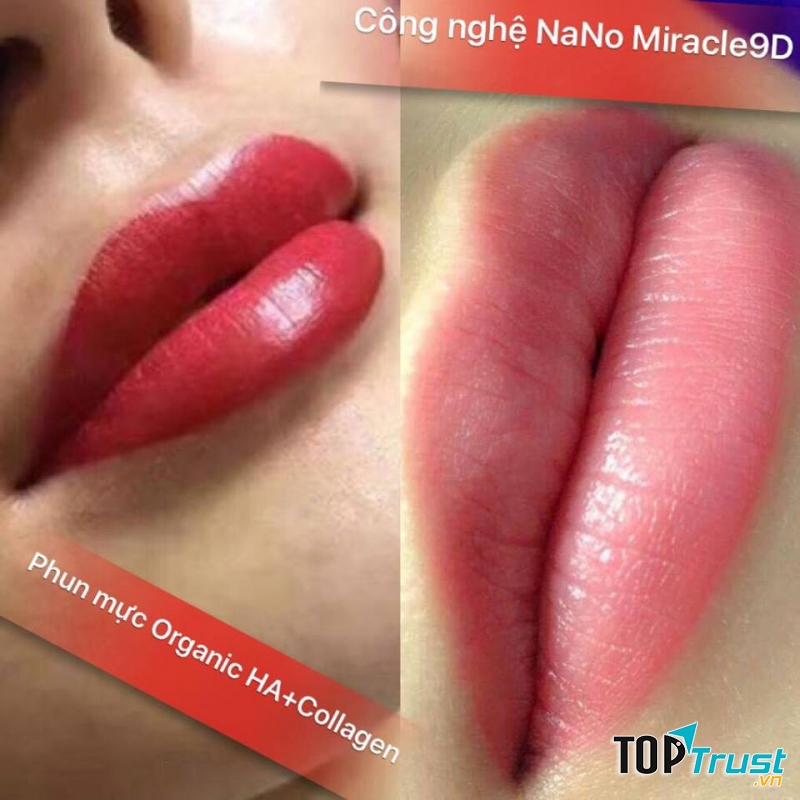 Thẩm mỹ viện Ngọc Linh