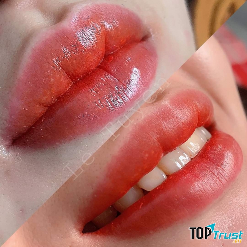 Thẩm Mỹ Viện Nguyên Nhung