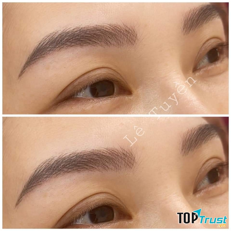 Thẩm Mỹ Viện Nguyên Nhung