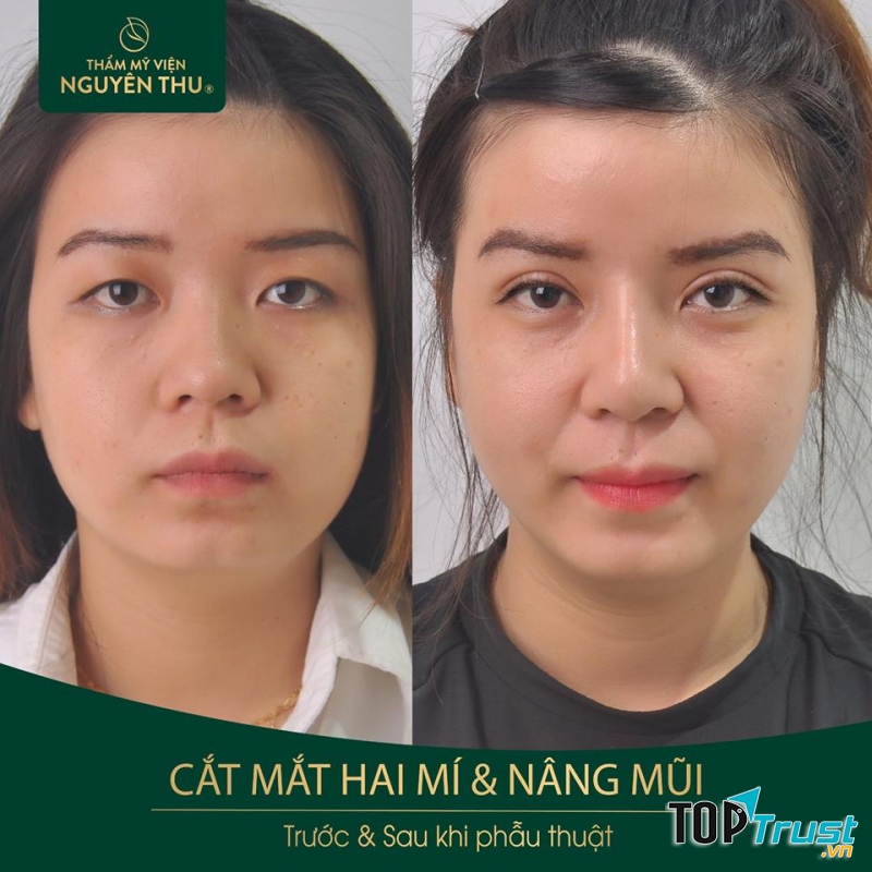 Thẩm Mỹ Viện Nguyên Thu