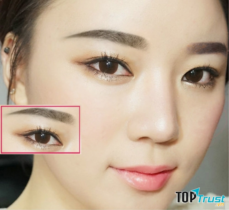 Thẩm mỹ viện Phú Xuân
