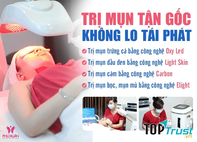 Nhưng công nghệ trị mụn tại Phú Xuân